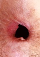 ATK Natural & Hairy: Jackie Hoff (Jackie Hoff Sexy Stripping)