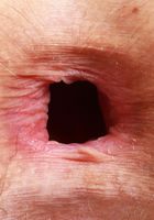 ATK Galleria: Jackie Hoff (Jackie Hoff Yoga Spreads and Gaping)