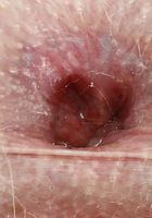 ATK Galleria: Jayme Rae (Jayme Rae in amateur)