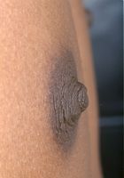 ATK Exotics: Kadia (Kadia in upskirts and panties)