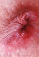 ATK Petites: Kallie Taylor (Kallie models her bright lingerie and hairy snatch)