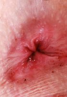 ATK Galleria: Kallie Taylor (Kallie Taylor Slow Striptease & Spreading)