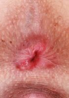 ATK Petites: Kallie Taylor (Blonde babe Kallie undresses and spreads)