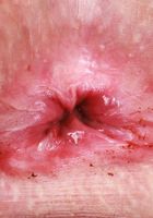 ATK Petites: Kallie Taylor (Kallie Taylor Miniskirt Tease & Ass Spreading)