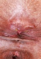 ATK Exotics: Kalani Luana (Kalani in cut-offs and a bikini top)