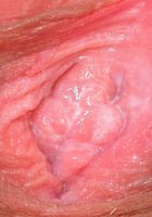 ATK Archives: Katia (Katia in upskirts and panties)