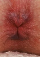 ATK Galleria: Kate Bloom (Kate Bloom Gets Undressed Outdoors)