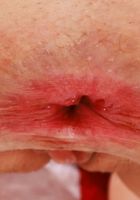 ATK Galleria: Kay Lovely (Kay Lovely Outside Spreading and Gaping)