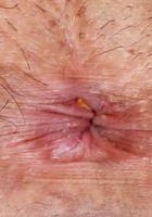 ATK Exotics: Kendall Woods (Red Hot Kenall Woods)