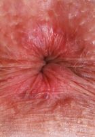 ATK Galleria: Kiley Corrupt (Kiley Corrupt Lingerie Mature Pussy Spreading)