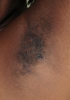 ATK Exotics: Lacey (Hairy Lacey shows off her black bush)