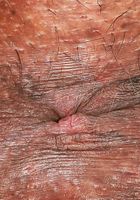 ATK Exotics: Lacey London (Lacey London Outdoor Spreading and Gaping.)