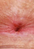 Lana Smalls Gaping holes, Lana Smalls (lan037) ATK Premium: Lana Smalls (Lana Smalls Gaping holes)