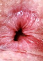 ATK Natural & Hairy: Lenna (Lenna bares everything and spreads her ass.)