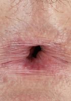 ATK Galleria: Lindsay Lee (Lindsay Lee in amateur)