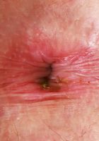 ATK Galleria: Lindsay Lee (Lindsay Lee Tight Red Dress)