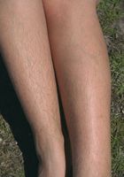 ATK Archives: Lois (Lois in nudism)