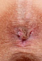 ATK Premium: Lola Asset (Strippin' bare with Lola Asset)