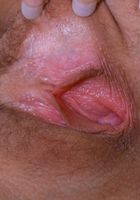 ATK Archives: Lorelei (Lorelei in)