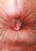 ATK Natural & Hairy: Lucy Sunflower (Lucy Sunflower Plays with her Pubes Outdoors)