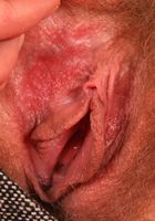 ATK Archives: Nefer (Nefer in the rain)