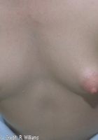 ATK Archives: Nicole (Nicole in nudism)