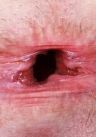 ATK Galleria: Nicole Nichols (Nicole's elegant black dress doesn't stay on for long.)