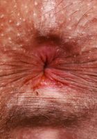 ATK Galleria: Nicole Luva (Nicole Luva Footfetish Pussy and Ass Spreading)