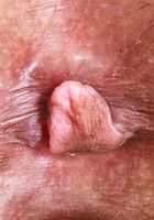 ATK Exotics: Olea James (Olea James has the tiniest pussy)