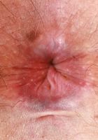 ATK Natural & Hairy: Olivia Marie (Olivia Marie Dress Outdoors)