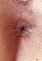 ATK Exotics: Penelope Woods (Penelope Woods Spreads her Ass)