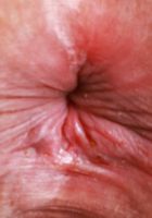 ATK Natural & Hairy: Remi Ferdinand (Remi Ferdinand Dress Strip Outdoors)