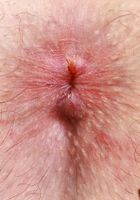 ATK Petites: Remi Raw (Remi Raw shows her pink, on the red carpet)