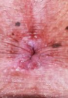 ATK Premium: Reyna Belle (Reyna Belle Footfetish Tease & Spreading)