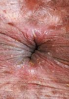 ATK Exotics: Rhae Woods (Rhae Woods likes to stay fit)