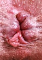 ATK Natural & Hairy: Riley Jean (Riley Jean has a hairy treat)