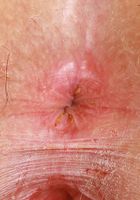 ATK Galleria: River Lynn (River Lynn Sexy Lingerie)