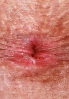 ATK Petites: Sage Hunter (Sage Hunter looking her best in blue)