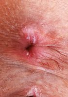 ATK Petites: Salee Lee (Salee Lee Blue Lingerie)