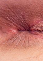 ATK Galleria: Shea Blaze (Shea Blaze in amateur)