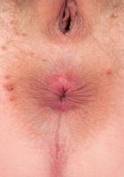 ATK Archives: Sian (Sian spreads her pussy.)