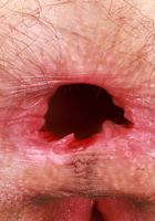 ATK Natural & Hairy: Sia Wood (Sia Wood is rocking a bikini and heels you won't soon forget)