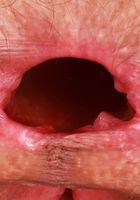 ATK Natural & Hairy: Sia Wood (Sia Wood's bush cannot be contained)