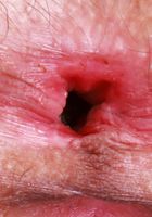 ATK Natural & Hairy: Sia Wood (Sia Wood Skirt Stripping)