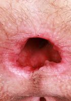 ATK Natural & Hairy: Sia Wood (Sia Wood Gapes her Ass Wide)