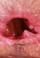 ATK Natural & Hairy: Sia Wood (Sia Wood gets playful on set)