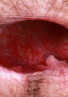 ATK Petites: Sia Wood (Sia Wood Stockings Big Bush Spreading)