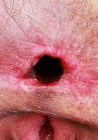 ATK Petites: Sia Wood (Check out the bush and pits on Sia Wood.)