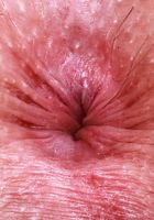 ATK Natural & Hairy: Stacey Barnes (Stacey Barnes Juicy Bubble Butt Hairy Pussy Spreads)