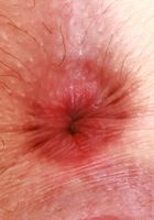 ATK Natural & Hairy: Stacey Barnes (Care to count all of Stacey Barnes hairs?)